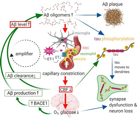 amyloid beta plaque|Aβ plaques .